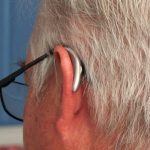 What is Occlusion and How Does it Affect the Wearing Comfort of Hearing Instruments?